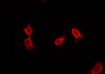 ADGRD2 / GPR144 Antibody - Staining HeLa cells by IF/ICC. The samples were fixed with PFA and permeabilized in 0.1% Triton X-100, then blocked in 10% serum for 45 min at 25°C. The primary antibody was diluted at 1:200 and incubated with the sample for 1 hour at 37°C. An Alexa Fluor 594 conjugated goat anti-rabbit IgG (H+L) Ab, diluted at 1/600, was used as the secondary antibody.