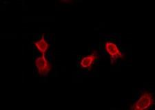ADGRD2 / GPR144 Antibody - Staining HeLa cells by IF/ICC. The samples were fixed with PFA and permeabilized in 0.1% Triton X-100, then blocked in 10% serum for 45 min at 25°C. The primary antibody was diluted at 1:200 and incubated with the sample for 1 hour at 37°C. An Alexa Fluor 594 conjugated goat anti-rabbit IgG (H+L) Ab, diluted at 1/600, was used as the secondary antibody.
