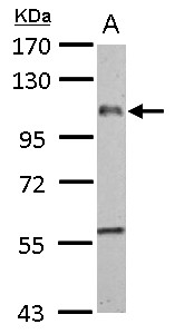 ADGRE1 / EMR1 Antibody - EMR1 antibody [C2C3], C-term detects EMR1 protein by Western blot analysis. A. 50 ug rat liver lysate/extract. 7.5 % SDS-PAGE. EMR1 antibody [C2C3], C-term dilution:1:1000
