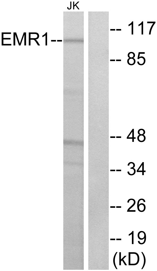 ADGRE1 / EMR1 Antibody - Western blot analysis of lysates from Jurkat cells, using EMR1 Antibody. The lane on the right is blocked with the synthesized peptide.