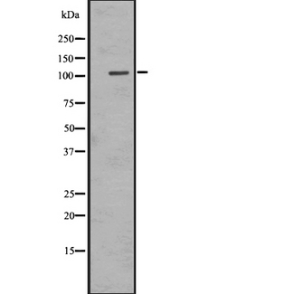 ADGRE1 / EMR1 Antibody - Western blot analysis of EMR1 expression in HEK293 cells. The lane on the left is treated with the antigen-specific peptide.