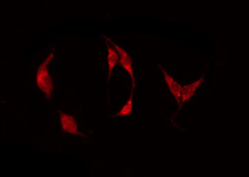 ADGRE1 / EMR1 Antibody - Staining HeLa cells by IF/ICC. The samples were fixed with PFA and permeabilized in 0.1% Triton X-100, then blocked in 10% serum for 45 min at 25°C. The primary antibody was diluted at 1:200 and incubated with the sample for 1 hour at 37°C. An Alexa Fluor 594 conjugated goat anti-rabbit IgG (H+L) Ab, diluted at 1/600, was used as the secondary antibody.