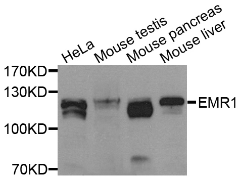 ADGRE1 / EMR1 Antibody - Western blot analysis of extracts of various cell lines, using EMR1 antibody at 1:1000 dilution. The secondary antibody used was an HRP Goat Anti-Rabbit IgG (H+L) at 1:10000 dilution. Lysates were loaded 25ug per lane and 3% nonfat dry milk in TBST was used for blocking. An ECL Kit was used for detection and the exposure time was 90s.