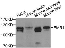 ADGRE1 / EMR1 Antibody - Western blot analysis of extracts of various cell lines, using EMR1 antibody at 1:1000 dilution. The secondary antibody used was an HRP Goat Anti-Rabbit IgG (H+L) at 1:10000 dilution. Lysates were loaded 25ug per lane and 3% nonfat dry milk in TBST was used for blocking. An ECL Kit was used for detection and the exposure time was 90s.