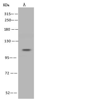 ADGRE1 / EMR1 Antibody - Anti-EMR1 rabbit polyclonal antibody at 1:500 dilution. Lane A: U-251 MG Whole Cell Lysate. Lysates/proteins at 30 ug per lane. Secondary: Goat Anti-Rabbit IgG (H+L)/HRP at 1/10000 dilution. Developed using the ECL technique. Performed under reducing conditions. Predicted band size: 102 kDa.