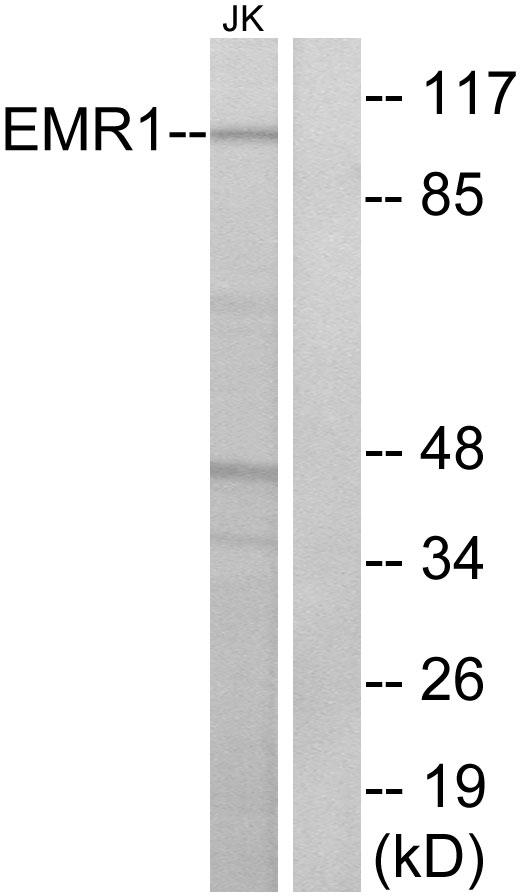ADGRE1 / EMR1 Antibody - Western blot analysis of extracts from Jurkat cells, using EMR1 antibody.