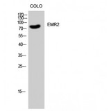 ADGRE2 / EMR2 Antibody - Western blot of EMR2 antibody