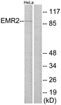 ADGRE2 / EMR2 Antibody - Western blot of extracts from HeLa cells, using EMR2 Antibody. The lane on the right is treated with the synthesized peptide.