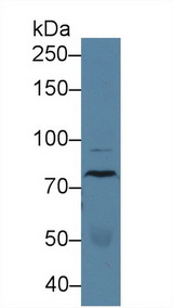 ADGRE2 / EMR2 Antibody - Western Blot; Sample: Human Serum; Primary Ab: 2µg/ml Rabbit Anti-Human EMR2 Antibody Second Ab: 0.2µg/mL HRP-Linked Caprine Anti-Rabbit IgG Polyclonal Antibody