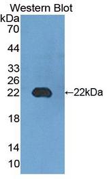 ADGRE2 / EMR2 Antibody - Western blot of ADGRE2 / EMR2 antibody.