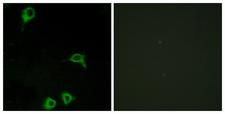 ADGRE2 / EMR2 Antibody - Immunofluorescence of COS7 cells, using EMR2 Antibody. The picture on the right is treated with the synthesized peptide.