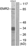 ADGRE2 / EMR2 Antibody - Western blot of extracts from COLO cells, using EMR2 Antibody. The lane on the right is treated with the synthesized peptide.