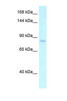 ADGRE2 / EMR2 Antibody - EMR2 antibody Western blot of PANC1 Cell lysate. Antibody concentration 1 ug/ml.  This image was taken for the unconjugated form of this product. Other forms have not been tested.