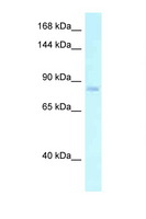 ADGRE2 / EMR2 Antibody - EMR2 antibody Western blot of PANC1 Cell lysate. Antibody concentration 1 ug/ml.  This image was taken for the unconjugated form of this product. Other forms have not been tested.