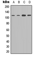 ADGRE2 / EMR2 Antibody - Western blot analysis of EMR2 expression in SHSY5Y (A); A549 (B); NIH3T3 (C); mouse liver (D) whole cell lysates.