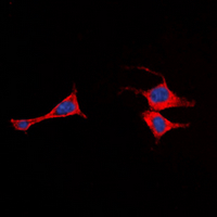 ADGRE2 / EMR2 Antibody - Immunofluorescent analysis of EMR2 staining in SHSY5Y cells. Formalin-fixed cells were permeabilized with 0.1% Triton X-100 in TBS for 5-10 minutes and blocked with 3% BSA-PBS for 30 minutes at room temperature. Cells were probed with the primary antibody in 3% BSA-PBS and incubated overnight at 4 deg C in a humidified chamber. Cells were washed with PBST and incubated with a DyLight 594-conjugated secondary antibody (red) in PBS at room temperature in the dark. DAPI was used to stain the cell nuclei (blue).