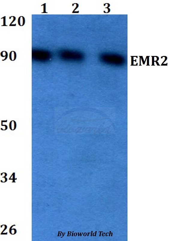 ADGRE2 / EMR2 Antibody - Western blot of EMR2 antibody at 1:500 dilution. Lane 1: HEK293T whole cell lysate. Lane 2: Raw264.7 whole cell lysate. Lane 3: PC12 whole cell lysate.