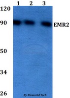 ADGRE2 / EMR2 Antibody - Western blot of EMR2 antibody at 1:500 dilution. Lane 1: HEK293T whole cell lysate. Lane 2: Raw264.7 whole cell lysate. Lane 3: PC12 whole cell lysate.