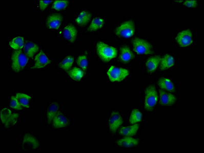 ADGRE2 / EMR2 Antibody - Immunofluorescence staining of Hela cells diluted at 1:166, counter-stained with DAPI. The cells were fixed in 4% formaldehyde, permeabilized using 0.2% Triton X-100 and blocked in 10% normal Goat Serum. The cells were then incubated with the antibody overnight at 4°C.The Secondary antibody was Alexa Fluor 488-congugated AffiniPure Goat Anti-Rabbit IgG (H+L).