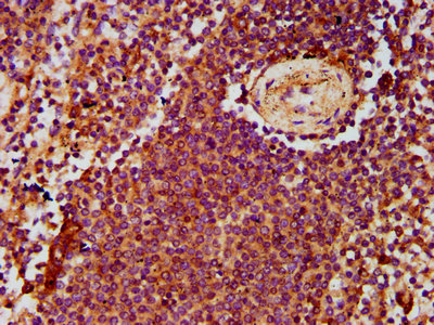 ADGRE2 / EMR2 Antibody - Immunohistochemistry Dilution at 1:500 and staining in paraffin-embedded human spleen tissue performed on a Leica BondTM system. After dewaxing and hydration, antigen retrieval was mediated by high pressure in a citrate buffer (pH 6.0). Section was blocked with 10% normal Goat serum 30min at RT. Then primary antibody (1% BSA) was incubated at 4°C overnight. The primary is detected by a biotinylated Secondary antibody and visualized using an HRP conjugated SP system.