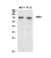 ADGRE2 / EMR2 Antibody - Western Blot analysis of extracts from MCF7, PC12 cells using EMR2 Antibody.