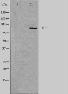ADGRE2 / EMR2 Antibody - Western blot analysis of extracts of COLO cells using EMR2 antibody. The lane on the left is treated with the antigen-specific peptide.