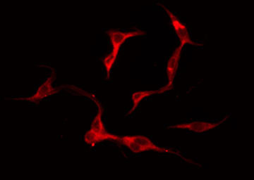 ADGRE2 / EMR2 Antibody - Staining COLO205 cells by IF/ICC. The samples were fixed with PFA and permeabilized in 0.1% Triton X-100, then blocked in 10% serum for 45 min at 25°C. The primary antibody was diluted at 1:200 and incubated with the sample for 1 hour at 37°C. An Alexa Fluor 594 conjugated goat anti-rabbit IgG (H+L) Ab, diluted at 1/600, was used as the secondary antibody.