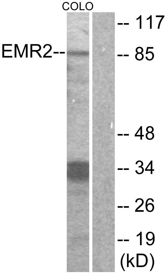 ADGRE2 / EMR2 Antibody - Western blot analysis of extracts from COLO cells, using EMR2 antibody.