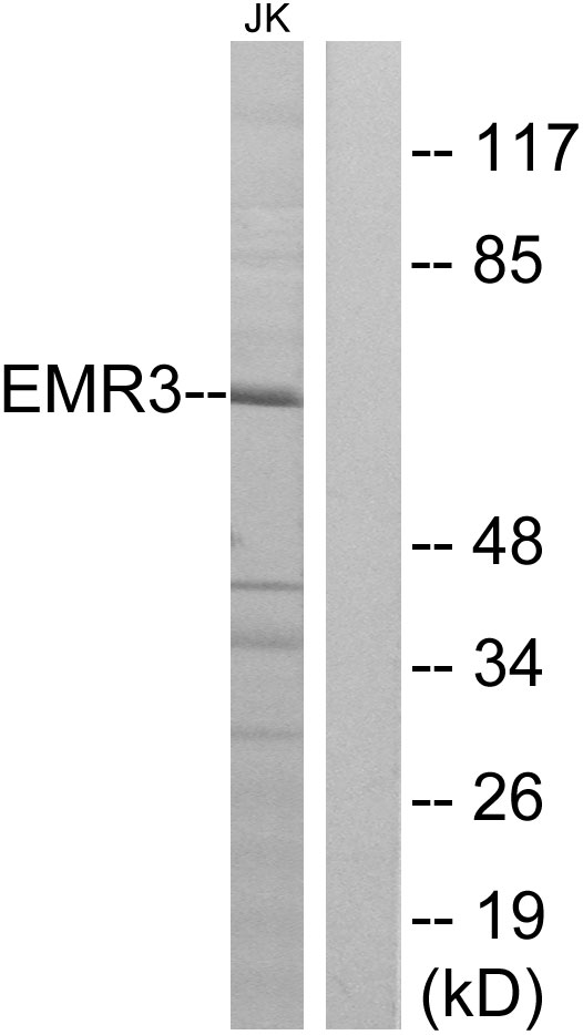 ADGRE3 / EMR3 Antibody - Western blot analysis of lysates from Jurkat cells, using EMR3 Antibody. The lane on the right is blocked with the synthesized peptide.
