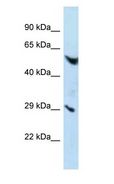 ADGRE3 / EMR3 Antibody - EMR3 antibody Western Blot of HepG2. Antibody dilution: 1 ug/ml.  This image was taken for the unconjugated form of this product. Other forms have not been tested.