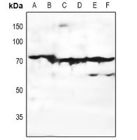 ADGRE3 / EMR3 Antibody - Western blot analysis of EMR3 expression in HEK293T (A), H1975 (B), mouse liver (C), mouse kidney (D), rat liver (E), rat kidney (F) whole cell lysates.