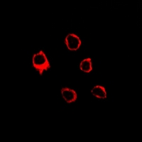 ADGRE3 / EMR3 Antibody - Immunofluorescent analysis of EMR3 staining in LOVO cells. Formalin-fixed cells were permeabilized with 0.1% Triton X-100 in TBS for 5-10 minutes and blocked with 3% BSA-PBS for 30 minutes at room temperature. Cells were probed with the primary antibody in 3% BSA-PBS and incubated overnight at 4 °C in a hidified chamber. Cells were washed with PBST and incubated with Alexa Fluor 647-conjugated secondary antibody (red) in PBS at room temperature in the dark.