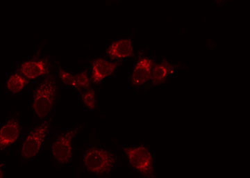 ADGRE3 / EMR3 Antibody - Staining HeLa cells by IF/ICC. The samples were fixed with PFA and permeabilized in 0.1% Triton X-100, then blocked in 10% serum for 45 min at 25°C. The primary antibody was diluted at 1:200 and incubated with the sample for 1 hour at 37°C. An Alexa Fluor 594 conjugated goat anti-rabbit IgG (H+L) Ab, diluted at 1/600, was used as the secondary antibody.