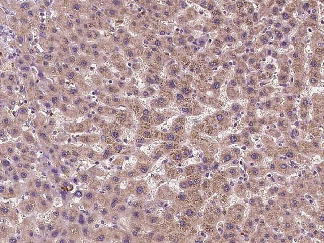 ADGRE3 / EMR3 Antibody - Immunochemical staining of human EMR3 in human liver with rabbit polyclonal antibody at 1:100 dilution, formalin-fixed paraffin embedded sections.