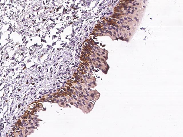 ADGRE3 / EMR3 Antibody - Immunochemical staining of human EMR3 in human urinary bladder with rabbit polyclonal antibody at 1:100 dilution, formalin-fixed paraffin embedded sections.