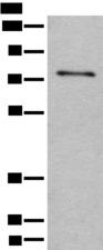 ADGRE3 / EMR3 Antibody - Western blot analysis of Human hepatocellular carcinoma 2 tissue lysate  using ADGRE3 Polyclonal Antibody at dilution of 1:400