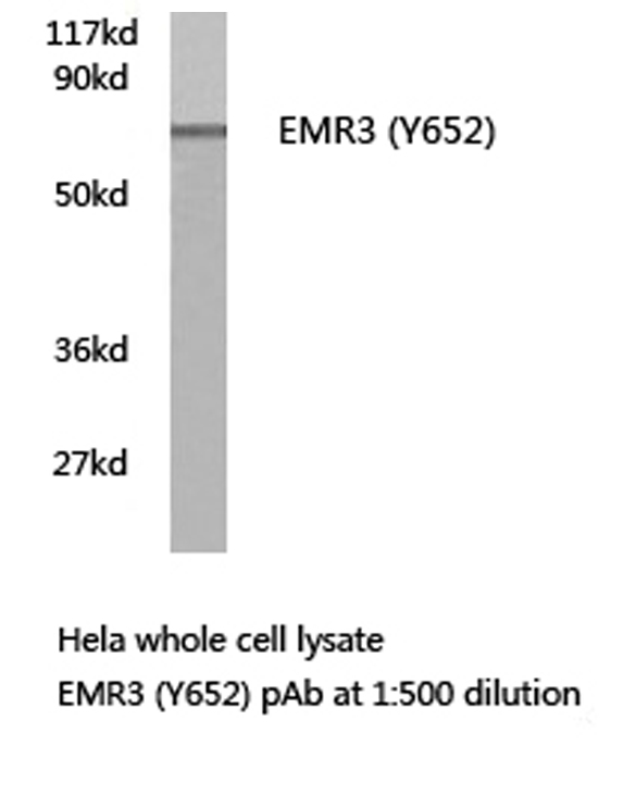 ADGRE3 / EMR3 Antibody - Western blot of EMR3 (Y652) pAb in extracts from HeLa cells.