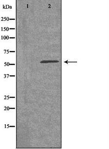 ADGRE4P / EMR4P Antibody - Western blot analysis of extracts of HuvEc cells using EMR4 antibody. The lane on the left is treated with the antigen-specific peptide.