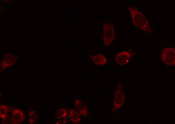 ADGRE4P / EMR4P Antibody - Staining HuvEc cells by IF/ICC. The samples were fixed with PFA and permeabilized in 0.1% Triton X-100, then blocked in 10% serum for 45 min at 25°C. The primary antibody was diluted at 1:200 and incubated with the sample for 1 hour at 37°C. An Alexa Fluor 594 conjugated goat anti-rabbit IgG (H+L) Ab, diluted at 1/600, was used as the secondary antibody.