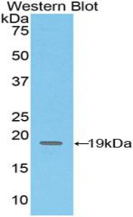 ADGRE5 / CD97 Antibody - Western blot of recombinant CD97.  This image was taken for the unconjugated form of this product. Other forms have not been tested.