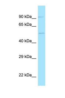 ADGRE5 / CD97 Antibody - CD97 antibody Western blot of Fetal Lung lysate. Antibody concentration 1 ug/ml.  This image was taken for the unconjugated form of this product. Other forms have not been tested.