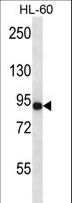 ADGRE5 / CD97 Antibody - CD97 Antibody western blot of HL-60 cell line lysates (35 ug/lane). The CD97 antibody detected the CD97 protein (arrow).