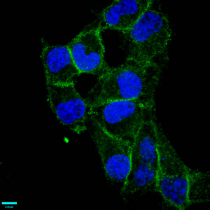 ADGRE5 / CD97 Antibody - Immunofluorescence staining of Hela cells diluted at 1:87.5,counter-stained with DAPI. The cells were fixed in 4% formaldehyde, permeabilized using 0.2% Triton X-100 and blocked in 10% normal Goat Serum. The cells were then incubated with the antibody overnight at 4°C.The Secondary antibody was Alexa Fluor 488-congugated AffiniPure Goat Anti-Rabbit IgG (H+L).