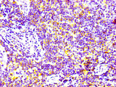 ADGRE5 / CD97 Antibody - Immunohistochemistry Dilution at 1:100 and staining in paraffin-embedded human lymph node tissue performed on a Leica BondTM system. After dewaxing and hydration, antigen retrieval was mediated by high pressure in a citrate buffer (pH 6.0). Section was blocked with 10% normal Goat serum 30min at RT. Then primary antibody (1% BSA) was incubated at 4°C overnight. The primary is detected by a biotinylated Secondary antibody and visualized using an HRP conjugated SP system.