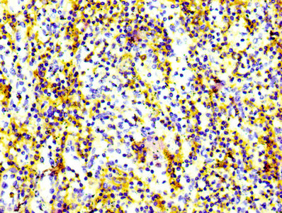 ADGRE5 / CD97 Antibody - Immunohistochemistry Dilution at 1:100 and staining in paraffin-embedded human spleen tissue performed on a Leica BondTM system. After dewaxing and hydration, antigen retrieval was mediated by high pressure in a citrate buffer (pH 6.0). Section was blocked with 10% normal Goat serum 30min at RT. Then primary antibody (1% BSA) was incubated at 4°C overnight. The primary is detected by a biotinylated Secondary antibody and visualized using an HRP conjugated SP system.