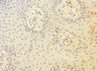 ADGRE5 / CD97 Antibody - Immunohistochemistry of paraffin-embedded human tonsil tissue at dilution 1:100