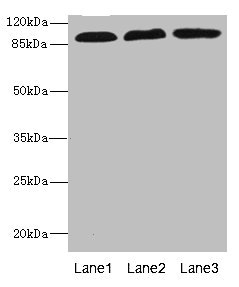ADGRE5 / CD97 Antibody - Western blot All Lanes: CD97 antibody at 3.11ug/ml Lane 1: HL60 whole cell lysate Lane 2: HepG-2 whole cell lysate Lane 3: Jurkat whole cell lysate Secondary Goat polyclonal to rabbit IgG at 1/10000 dilution Predicted band size: 92,82,87 kDa Observed band size: 92 kDa