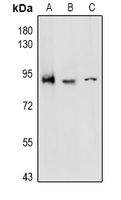 ADGRE5 / CD97 Antibody - Western blot analysis of CD97 alpha expression in Jurkat (A), HCT116 (B), H9C2 (C) whole cell lysates.