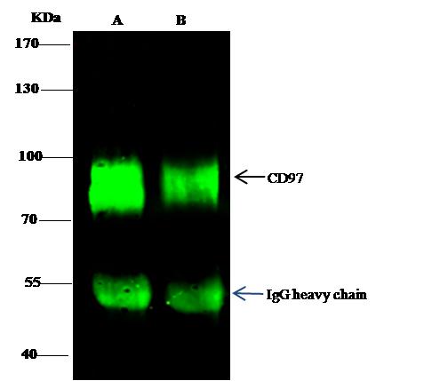 ADGRE5 / CD97 Antibody - CD97 was immunoprecipitated using: Lane A: 0.5 mg Hela Whole Cell Lysate. Lane B: 0.5 mg SW480 Whole Cell Lysate. 0.5 uL anti-CD97 rabbit polyclonal antibody and 15 ul of 50% Protein G agarose. Primary antibody: Anti-CD97 rabbit polyclonal antibody, at 1:500 dilution. Secondary antibody: Dylight 800-labeled antibody to rabbit IgG (H+L), at 1:5000 dilution. Developed using the odssey technique. Performed under reducing conditions. Predicted band size: 92 kDa. Observed band size: 92 kDa.