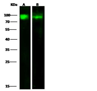 ADGRE5 / CD97 Antibody - Anti-CD97 rabbit polyclonal antibody at 1:500 dilution. Lane A: HL-60 Whole Cell Lysate. Lane B: Hela Whole Cell Lysate. Lysates/proteins at 30 ug per lane. Secondary: Goat Anti-Rabbit IgG H&L (Dylight800) at 1/10000 dilution. Developed using the Odyssey technique. Performed under reducing conditions. Predicted band size: 92 kDa. Observed band size: 92 kDa.